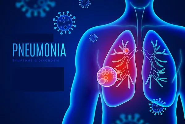Pneumonia