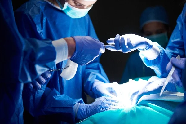 Vasectomy